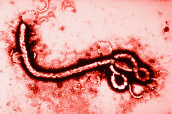 Che cos’è l’Ebola? Da dove deriva e come riconoscerlo.